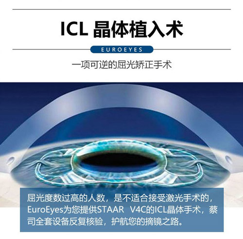ICL晶体植入矫正近视前后对比