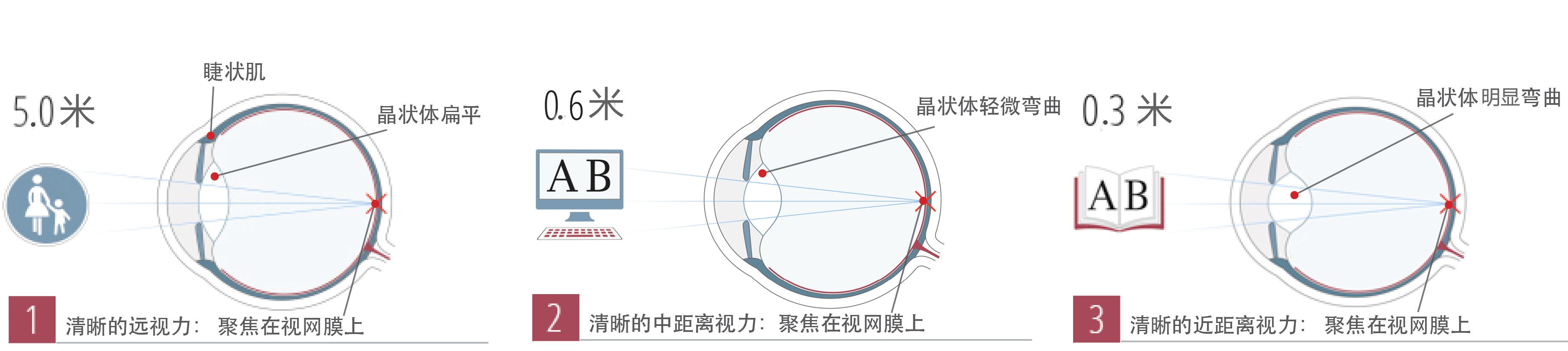 近视老花眼区别