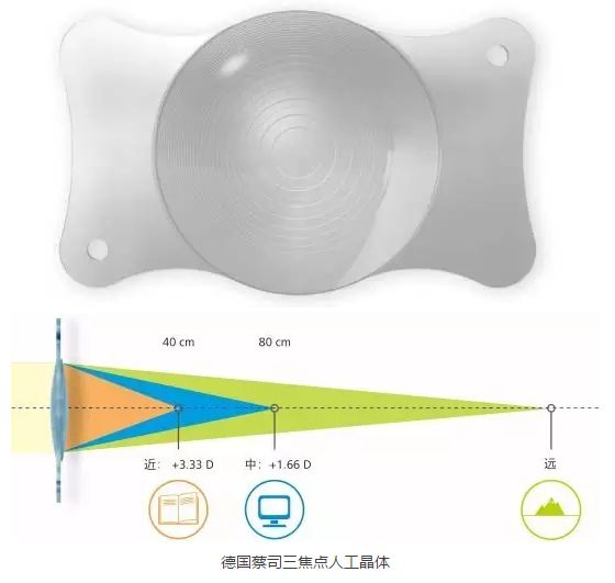 三焦晶体优缺点