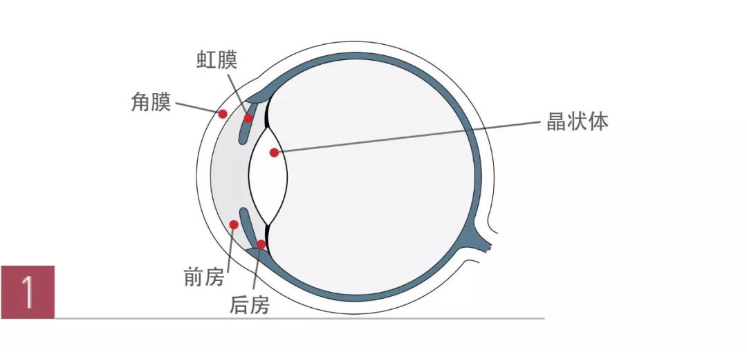 icl晶体植入位置