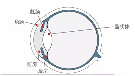 孩子眼睛高度近视怎么办？