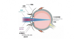 什么是远视眼？请你看近