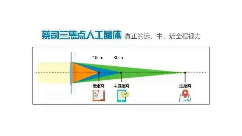老花眼的症状