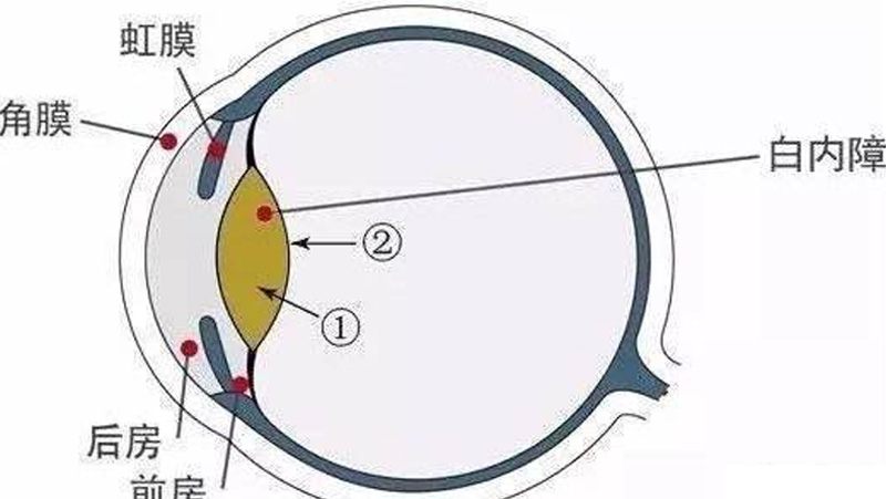 白内障的症状及手术方法是什么？