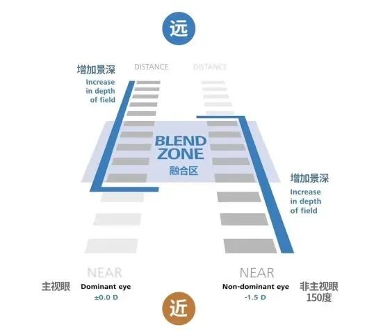 40岁到底还能不能做近视手