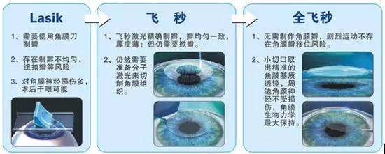 做半飞秒还是全飞秒好 上海德视佳眼科