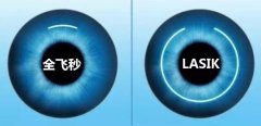 上海全飞秒激光矫正近视术Smile