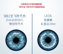 上海近视600度可以矫正吗？
